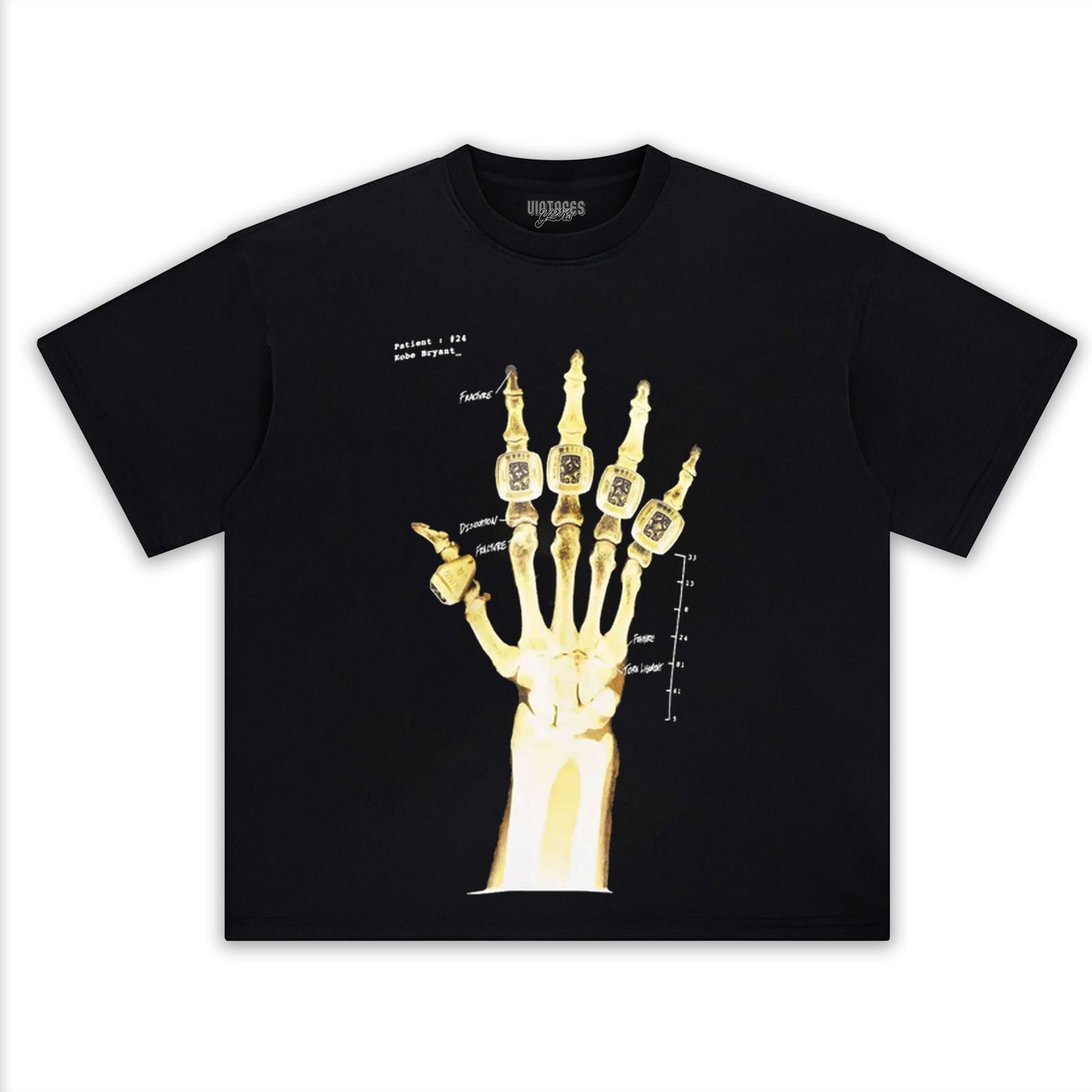 KOBE X-RAY “BROKEN NOT BEATEN” TEE